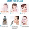 4 in 1 Multi-functional Black Head Removal Machine Derma Suction Blackhead Remover
