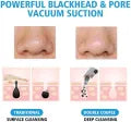 4 in 1 Multi-functional Black Head Removal Machine Derma Suction Blackhead Remover
